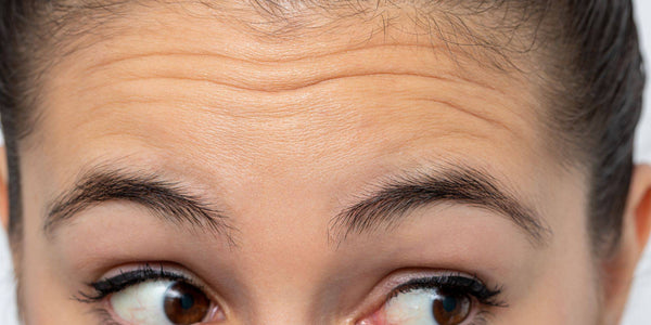 forehead lift in Korean plastic surgery