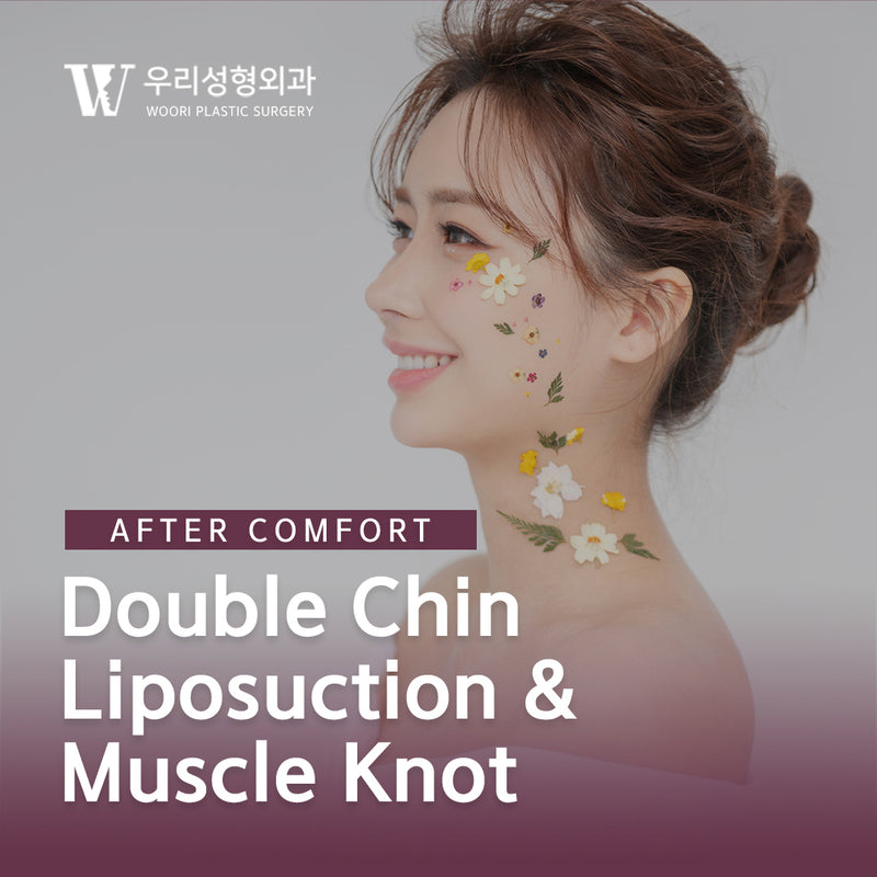 Double Chin Liposuction & Muscle Knot